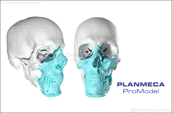 A Face Transplant Operation is a Demonstration of Advanced Surgery and High Technology